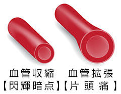 血管収縮【閃輝暗点】 血管拡張【片頭痛】