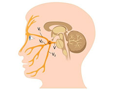 頭痛の原因のイメージ