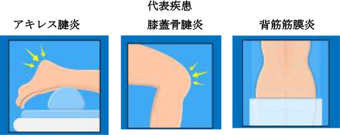 代表疾患