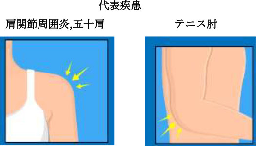 代表疾患