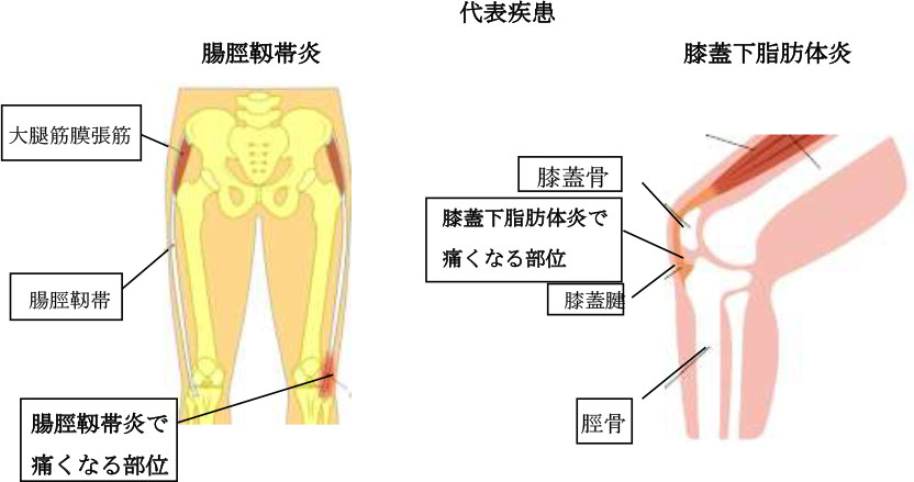 代表疾患