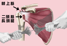 肩の筋肉は常に激しい負荷に晒されている